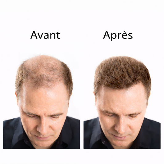 Poudre Épaississante pour Cheveux – Effet Volume Instantané & Camouflage des Zones Clairsemées